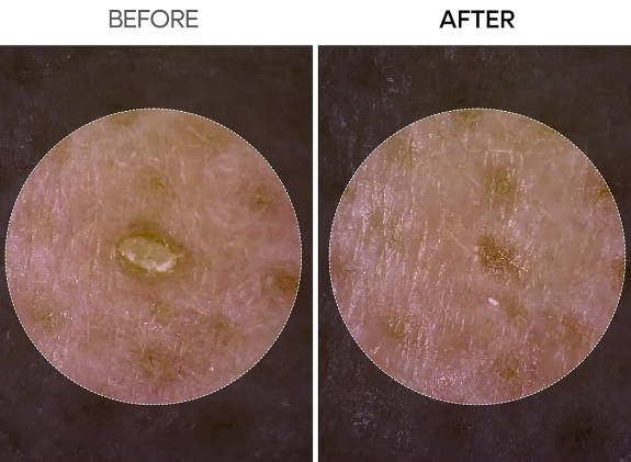 Dr. Melaxin Rice Peel Serum Ampoule™