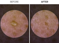 Dr. Melaxin Rice Peel Serum Ampoule™