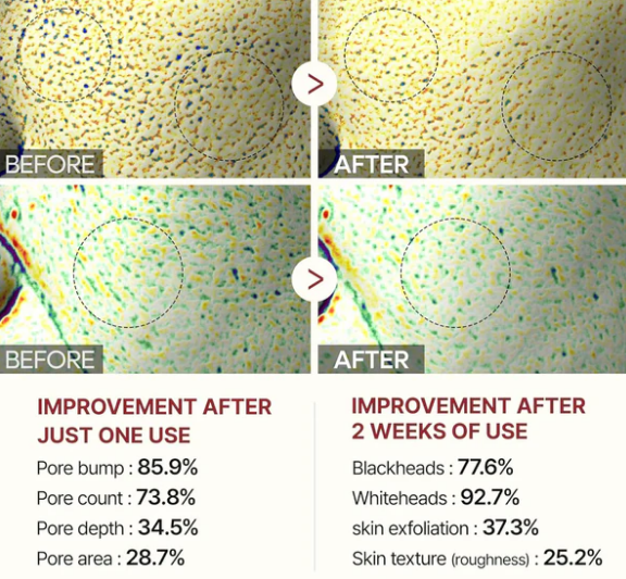 Dr. Melaxin Rice Peel Serum Ampoule™
